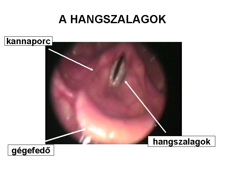 A HANGSZALAGOK kannaporc gégefedő hangszalagok A HANGSZALAGOK kannaporc gégefedő hangszalagok