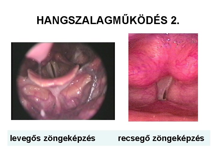 HANGSZALAGMŰKÖDÉS 2. levegős zöngeképzés recsegő zöngeképzés 