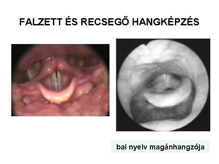 FALZETT ÉS RECSEGŐ HANGKÉPZÉS bai nyelv magánhangzója FALZETT ÉS RECSEGŐ HANGKÉPZÉS bai nyelv magánhangzója