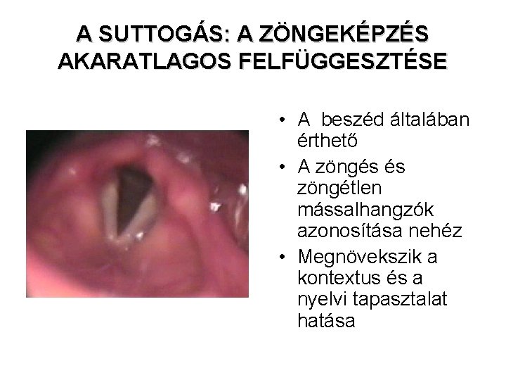 A SUTTOGÁS: A ZÖNGEKÉPZÉS AKARATLAGOS FELFÜGGESZTÉSE • A beszéd általában érthető • A zöngés A SUTTOGÁS: A ZÖNGEKÉPZÉS AKARATLAGOS FELFÜGGESZTÉSE • A beszéd általában érthető • A zöngés