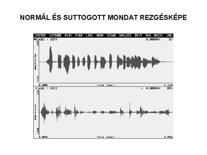 NORMÁL ÉS SUTTOGOTT MONDAT REZGÉSKÉPE NORMÁL ÉS SUTTOGOTT MONDAT REZGÉSKÉPE