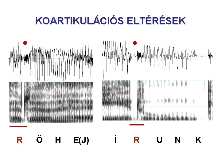 KOARTIKULÁCIÓS ELTÉRÉSEK R Ö H E(J) Í R U N K KOARTIKULÁCIÓS ELTÉRÉSEK R Ö H E(J) Í R U N K