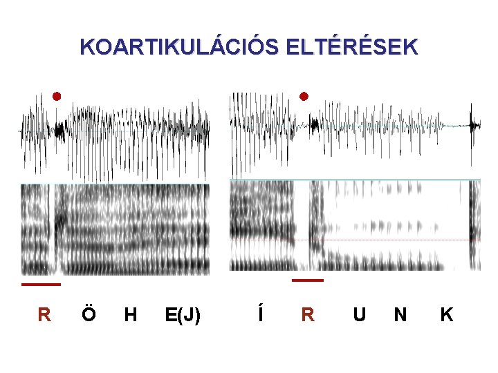 KOARTIKULÁCIÓS ELTÉRÉSEK R Ö H E(J) Í R U N K 