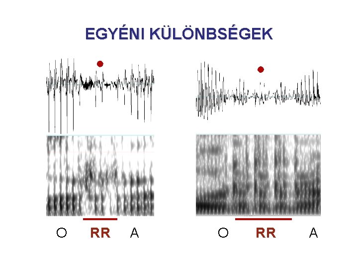 EGYÉNI KÜLÖNBSÉGEK O RR A EGYÉNI KÜLÖNBSÉGEK O RR A