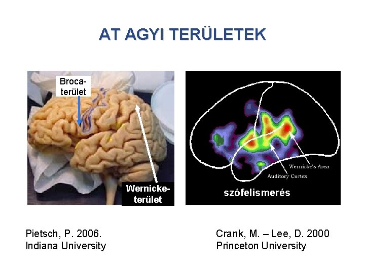 AT AGYI TERÜLETEK Brocaterület Wernicketerület Pietsch, P. 2006. Indiana University szófelismerés Crank, M. – AT AGYI TERÜLETEK Brocaterület Wernicketerület Pietsch, P. 2006. Indiana University szófelismerés Crank, M. –