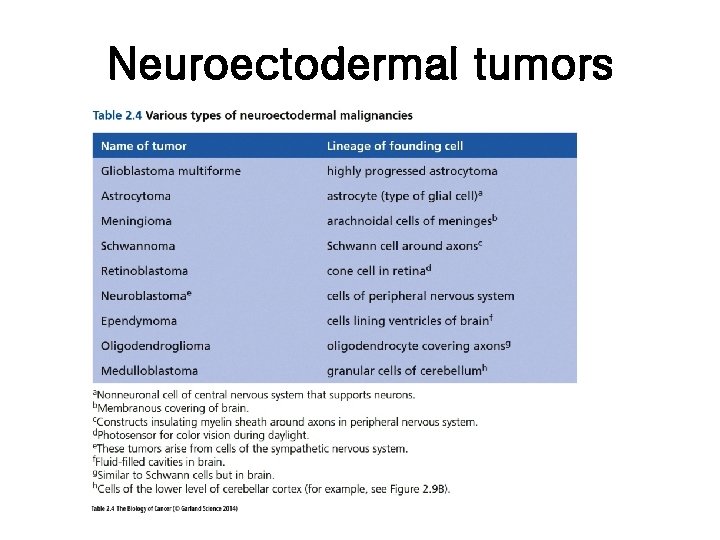 Neuroectodermal tumors 