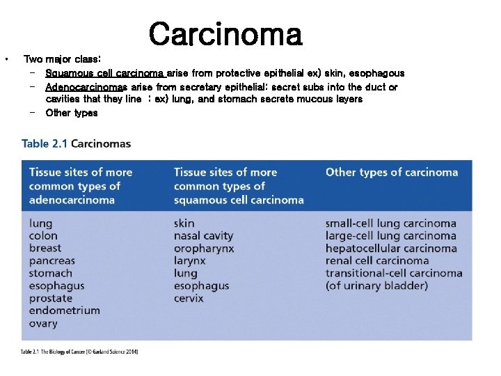 Carcinoma • Two major class: – Squamous cell carcinoma arise from protective epithelial ex)