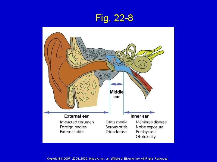 Fig. 22 -8 Copyright © 2007, 2004, 2000, Mosby, Inc. , an affiliate of