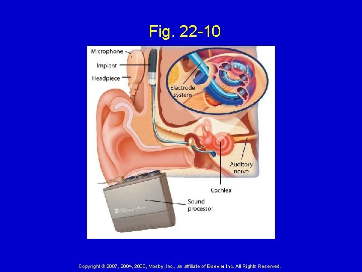 Fig. 22 -10 Copyright © 2007, 2004, 2000, Mosby, Inc. , an affiliate of