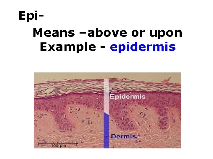Epi. Means –above or upon Example - epidermis 