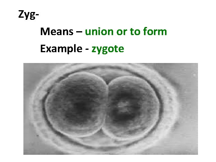Zyg- Means – union or to form Example - zygote 