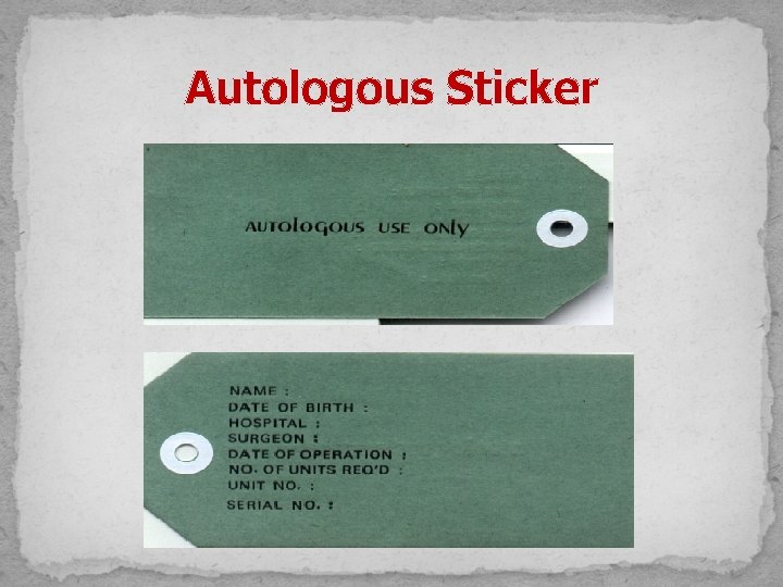 Autologous Sticker 