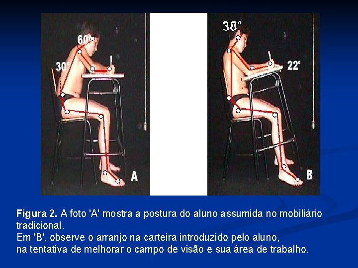 Figura 2. A foto 'A' mostra a postura do aluno assumida no mobiliário tradicional.