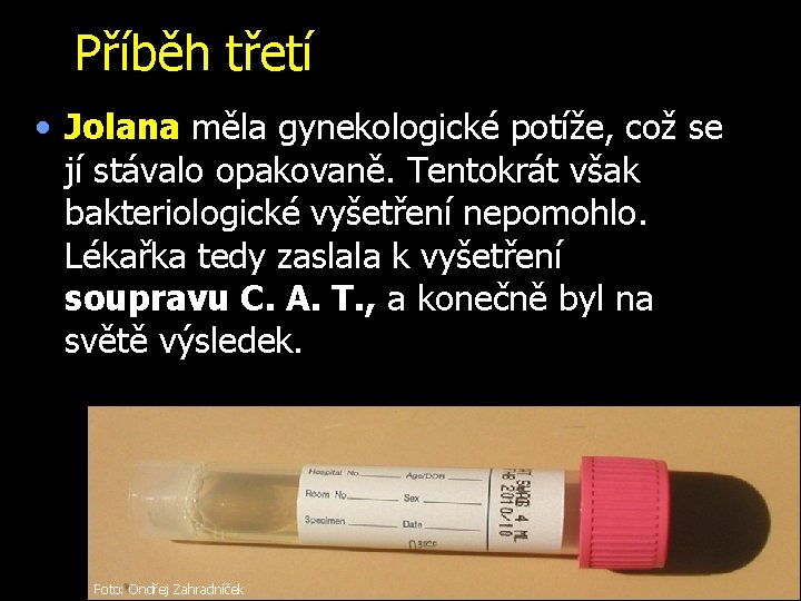 Příběh třetí • Jolana měla gynekologické potíže, což se jí stávalo opakovaně. Tentokrát však
