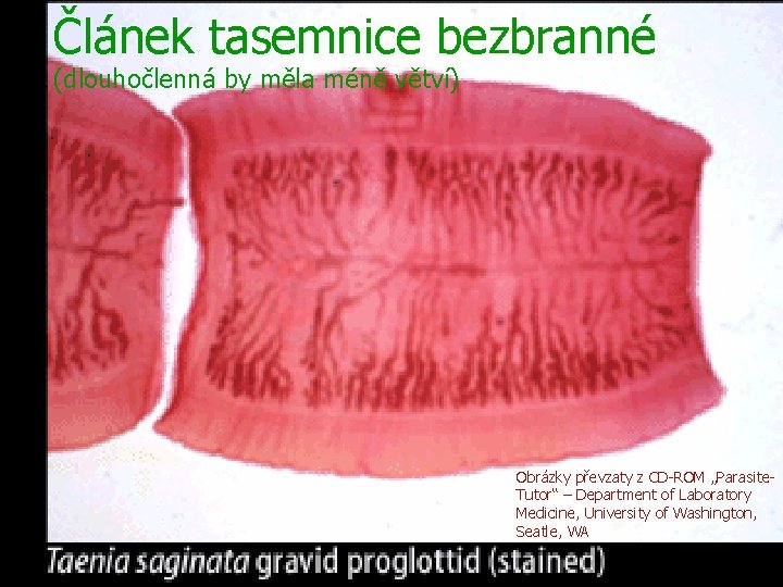 Článek tasemnice bezbranné (dlouhočlenná by měla méně větví) Obrázky převzaty z CD-ROM „Parasite. Tutor“