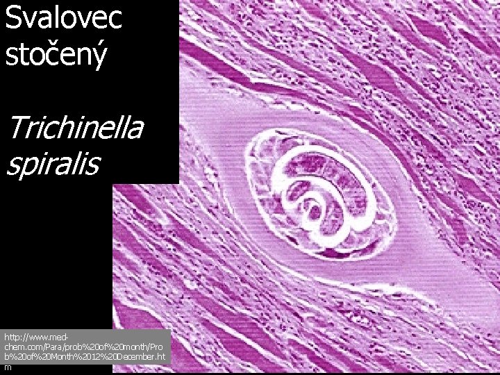 Svalovec stočený Trichinella spiralis http: //www. medchem. com/Para/prob%20 of%20 month/Pro b%20 of%20 Month%2012%20 December.