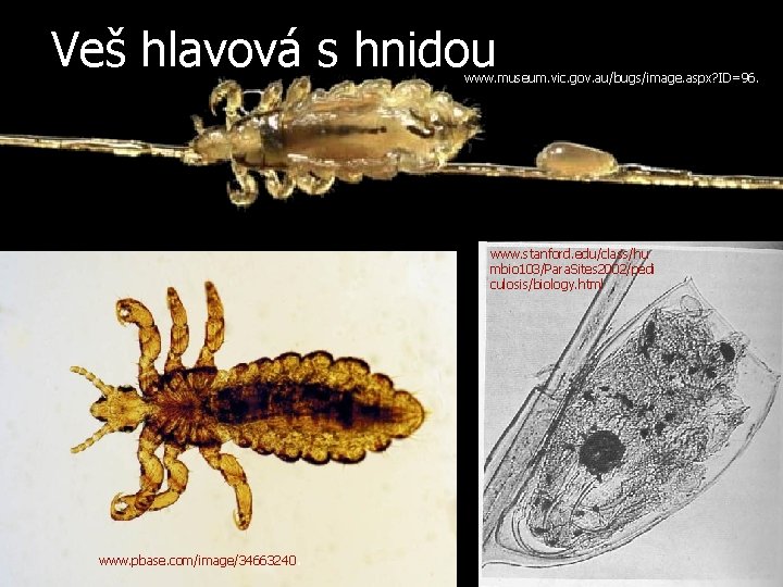 Veš hlavová s hnidou www. museum. vic. gov. au/bugs/image. aspx? ID=96. www. stanford. edu/class/hu