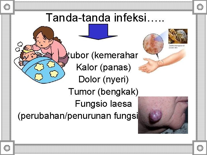 Tanda-tanda infeksi…. . Rubor (kemerahan) Kalor (panas) Dolor (nyeri) Tumor (bengkak) Fungsio laesa (perubahan/penurunan