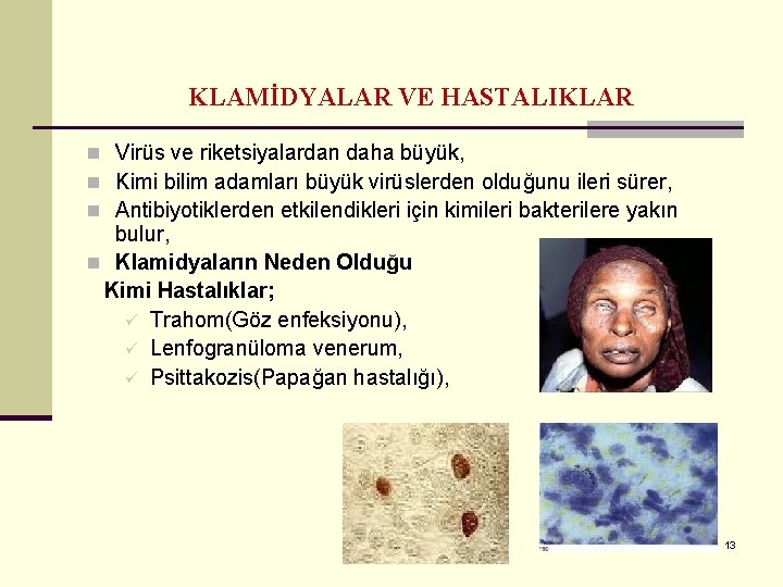 KLAMİDYALAR VE HASTALIKLAR n Virüs ve riketsiyalardan daha büyük, n Kimi bilim adamları büyük