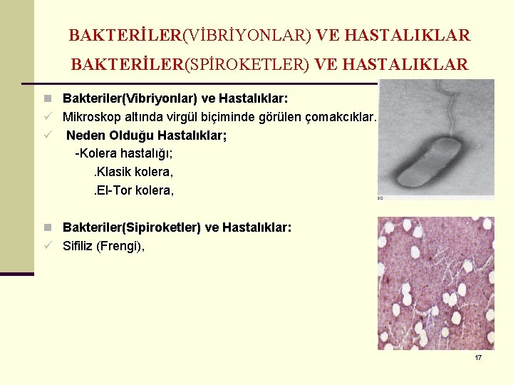 BAKTERİLER(VİBRİYONLAR) VE HASTALIKLAR BAKTERİLER(SPİROKETLER) VE HASTALIKLAR n Bakteriler(Vibriyonlar) ve Hastalıklar: ü Mikroskop altında virgül