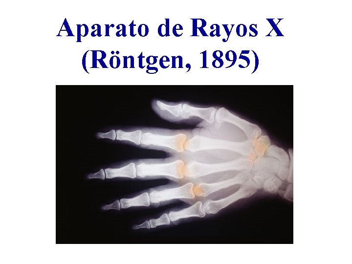 Aparato de Rayos X (Röntgen, 1895) 