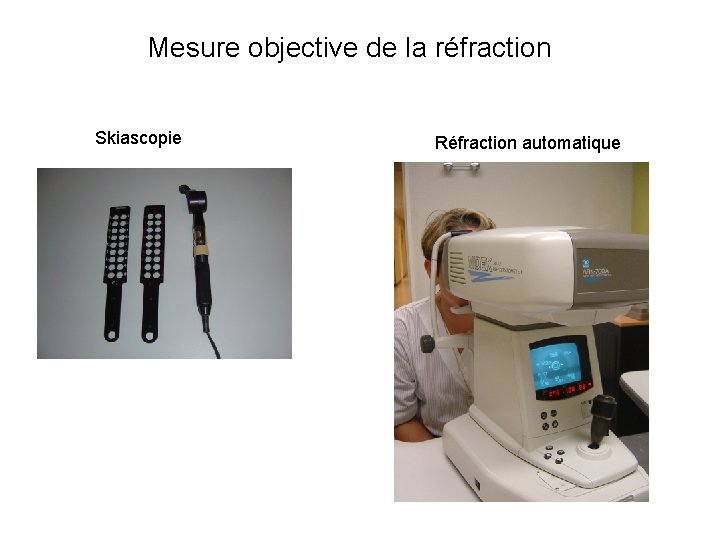Mesure objective de la réfraction Skiascopie Réfraction automatique 