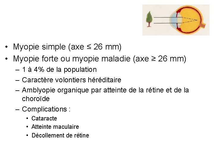  • Myopie simple (axe ≤ 26 mm) • Myopie forte ou myopie maladie