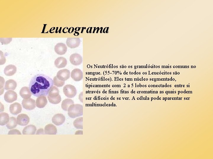 Leucograma Os Neutrófilos são os granulócitos mais comuns no sangue. (55 -70% de todos