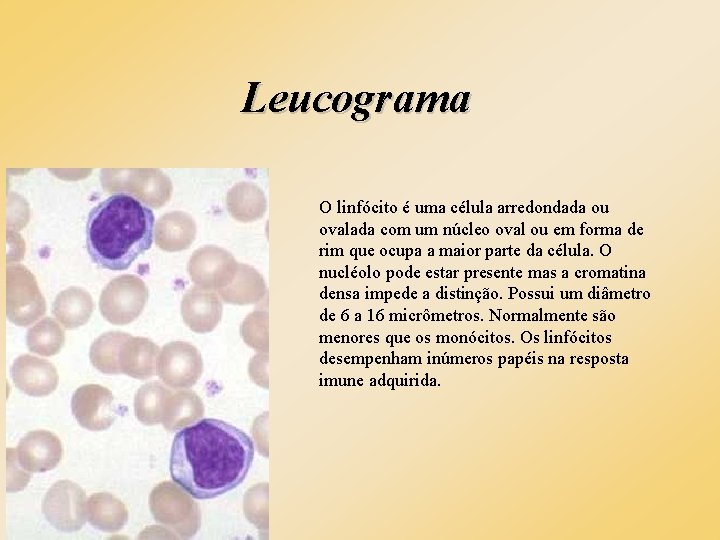 Leucograma O linfócito é uma célula arredondada ou ovalada com um núcleo oval ou