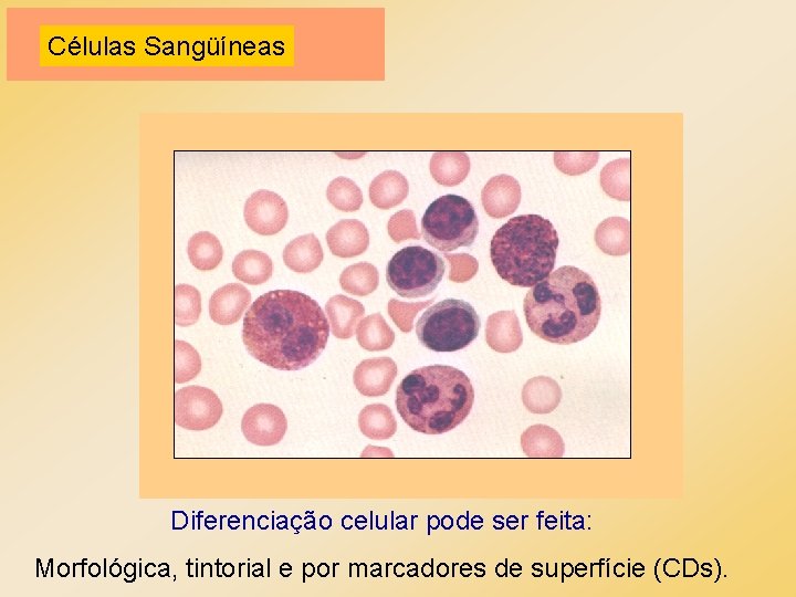 Células Sangüíneas Diferenciação celular pode ser feita: Morfológica, tintorial e por marcadores de superfície