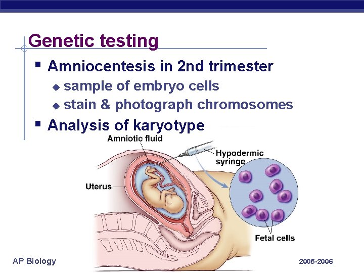 Genetic testing § Amniocentesis in 2 nd trimester sample of embryo cells u stain
