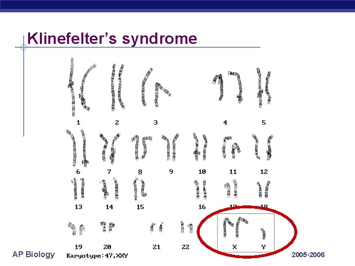 Klinefelter’s syndrome AP Biology 2005 -2006 