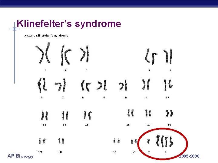 Klinefelter’s syndrome AP Biology 2005 -2006 