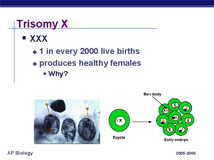 Trisomy X § XXX 1 in every 2000 live births u produces healthy females