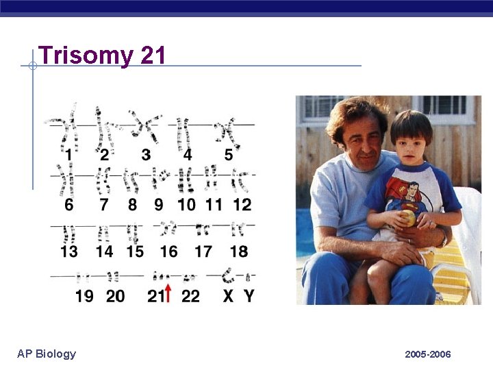 Trisomy 21 AP Biology 2005 -2006 