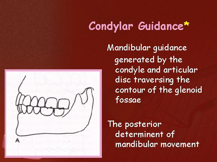 Condylar Guidance* Mandibular guidance generated by the condyle and articular disc traversing the contour