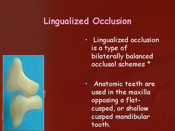 Lingualized Occlusion • Lingualized occlusion is a type of bilaterally balanced occlusal schemes *