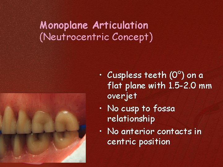 Monoplane Articulation (Neutrocentric Concept) • Cuspless teeth (0°) on a flat plane with 1.