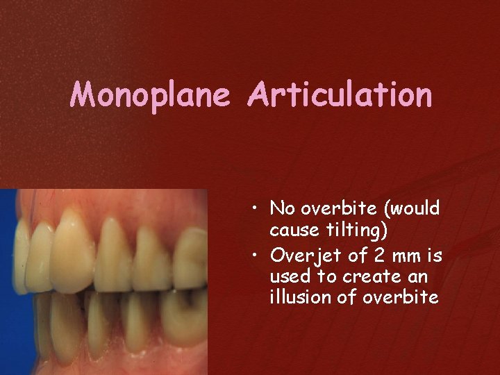 Monoplane Articulation • No overbite (would cause tilting) • Overjet of 2 mm is
