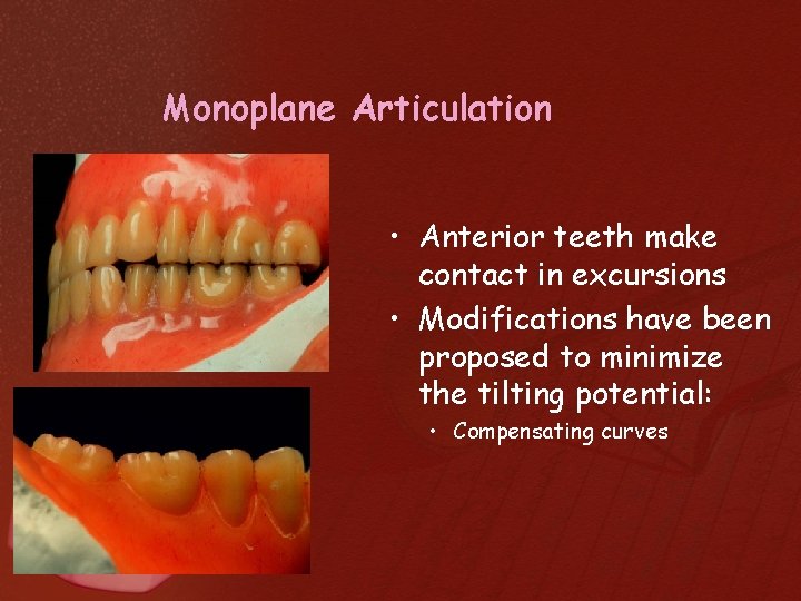 Monoplane Articulation • Anterior teeth make contact in excursions • Modifications have been proposed