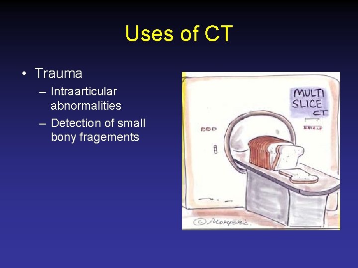 Uses of CT • Trauma – Intraarticular abnormalities – Detection of small bony fragements