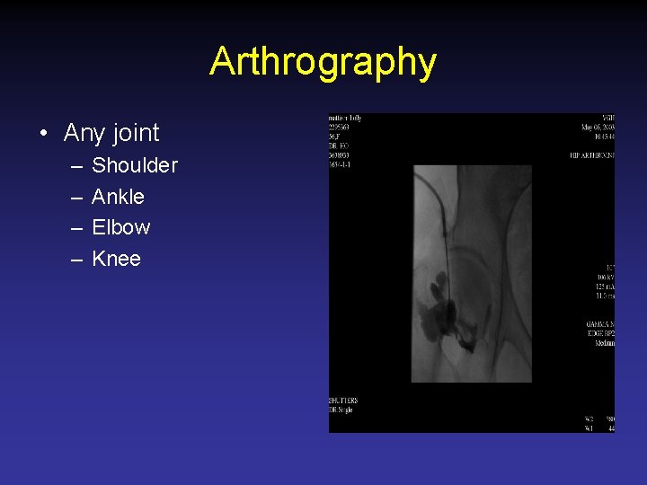 Arthrography • Any joint – – Shoulder Ankle Elbow Knee 