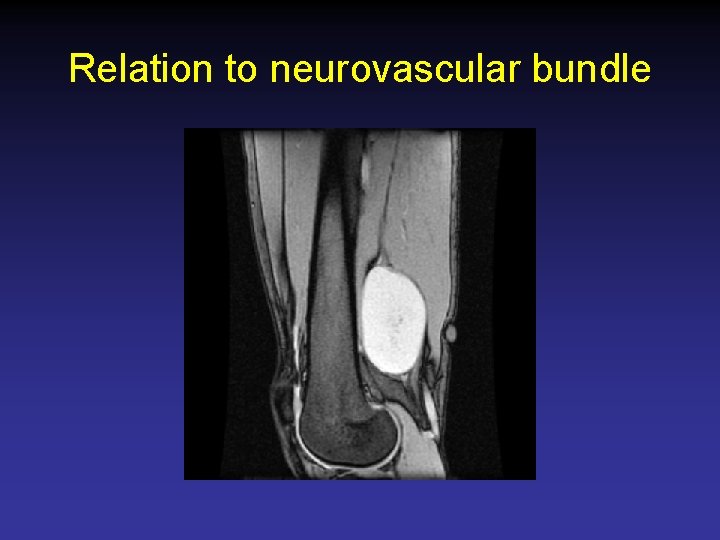 Relation to neurovascular bundle 