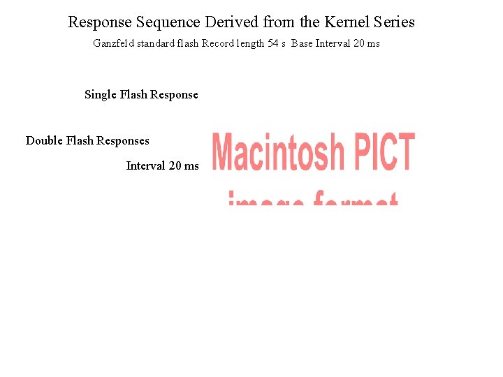 Response Sequence Derived from the Kernel Series Ganzfeld standard flash Record length 54 s