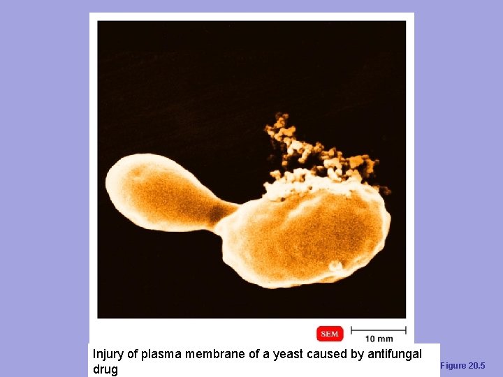 Injury of plasma membrane of a yeast caused by antifungal drug Figure 20. 5