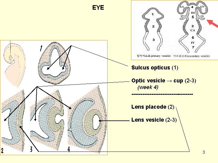 EYE Sulcus opticus (1) Optic vesicle → cup (2 -3) (week 4) -----------------Lens placode