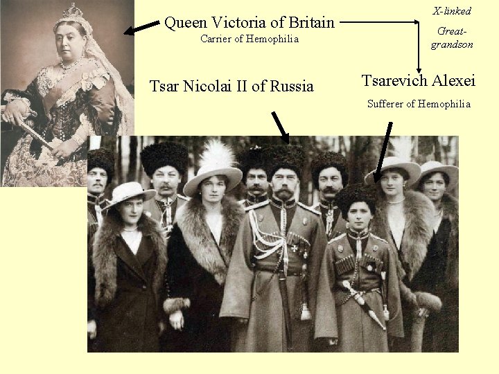 Queen Victoria of Britain Carrier of Hemophilia Tsar Nicolai II of Russia X-linked Greatgrandson