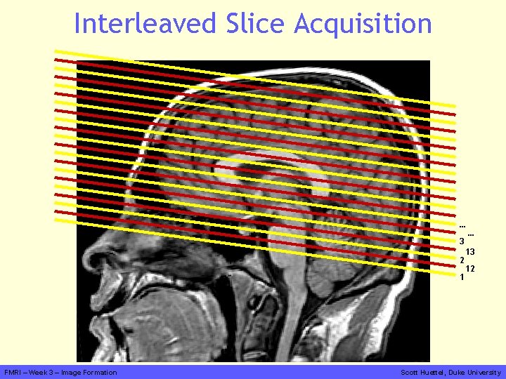 Interleaved Slice Acquisition … 3 2 1 FMRI – Week 3 – Image Formation