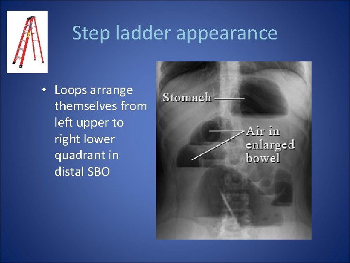 Step ladder appearance • Loops arrange themselves from left upper to right lower quadrant