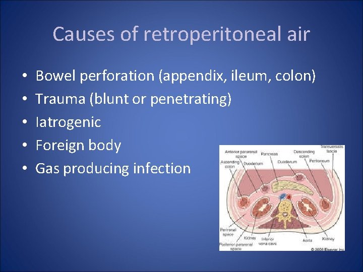 Causes of retroperitoneal air • • • Bowel perforation (appendix, ileum, colon) Trauma (blunt